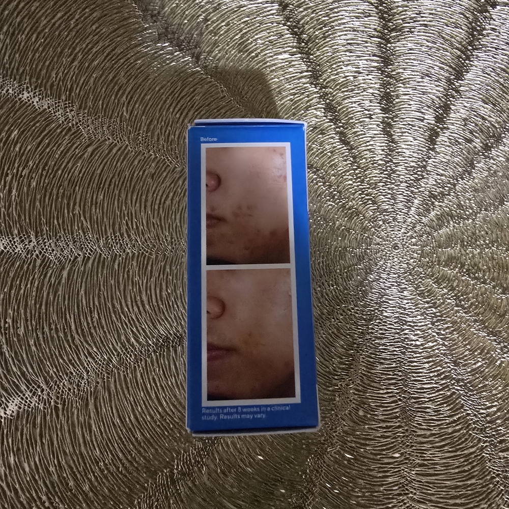 Murad Acne Treatment - Blue Box